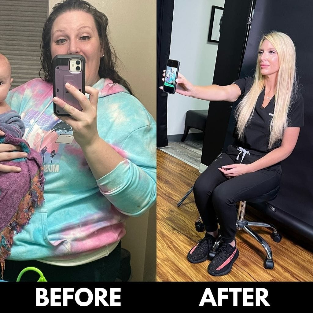 Jackie before and after losing 130 pounds in 9 months with GLP-1 medical weight loss at Express Med Spa