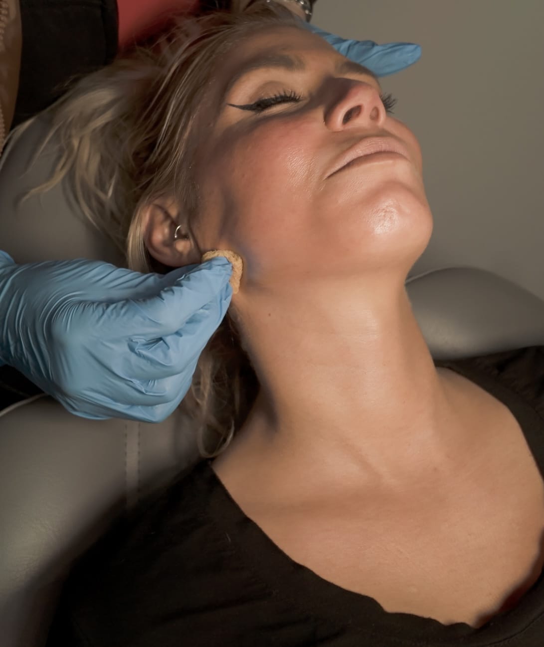 Close-up of a VI Peel being applied with focused care at Express Med Spa by a certified aesthetic provider