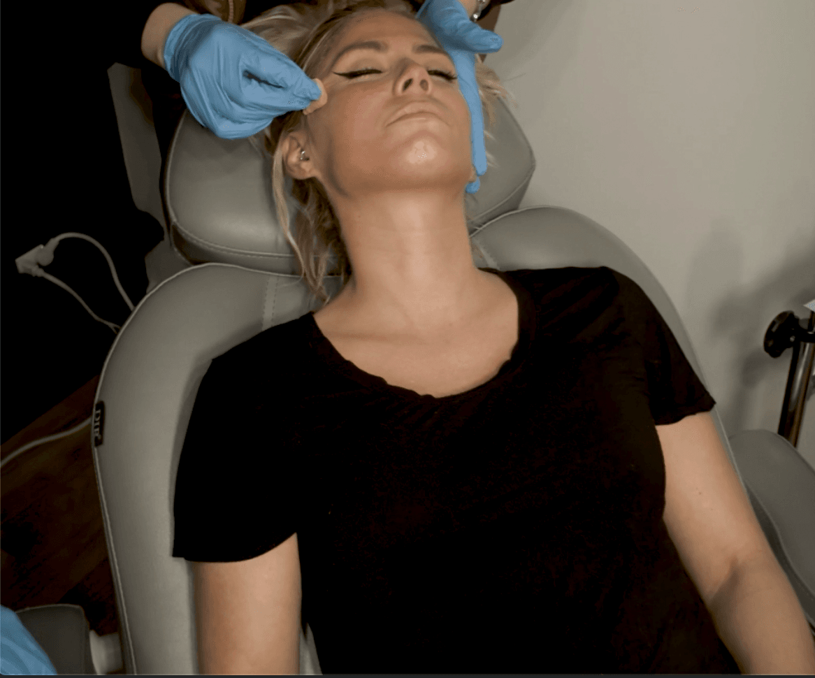 Woman receiving a VI Peel facial treatment at Express Med Spa in Chicago, calm and relaxed