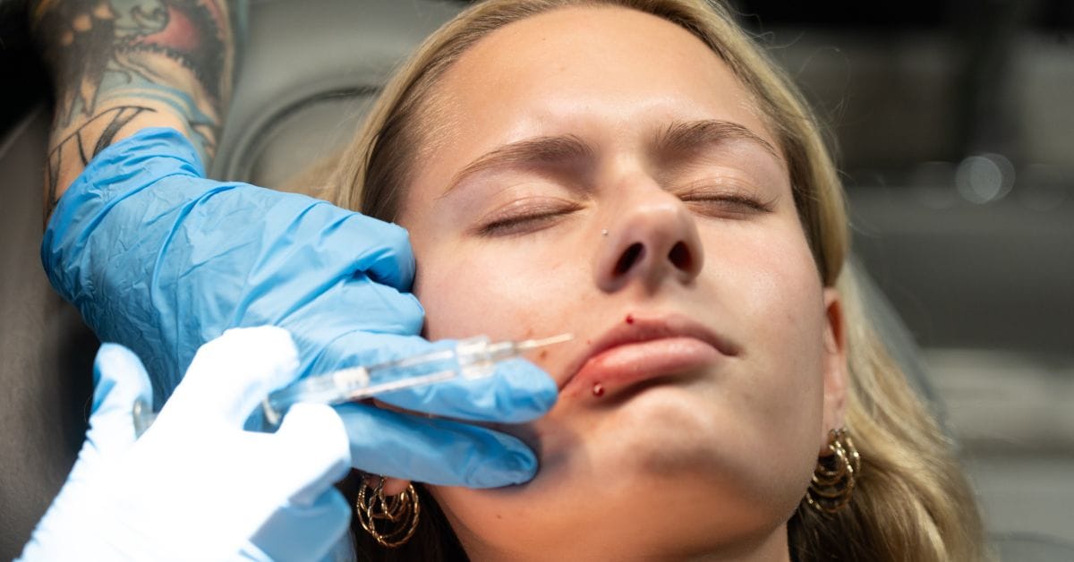 Featured image for “Can You Get Lip Filler While Pregnant? Safety Insights from Experts”
