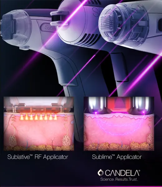 Candela Sublative and Sublime laser applicators showing advanced RF and infrared technology used at Express Med Spa Frankfort IL