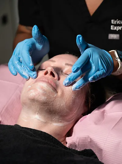 Gloved provider applying a chemical peel to a reclining client's face at Express Med Spa in Manteno, IL