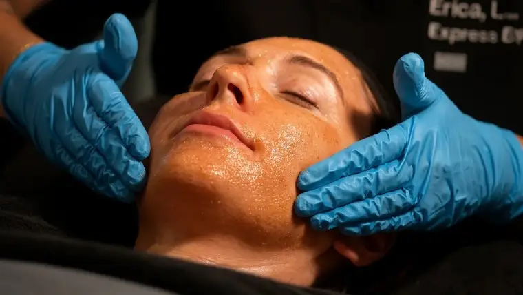 Chemical Peels ( VI Peel )
