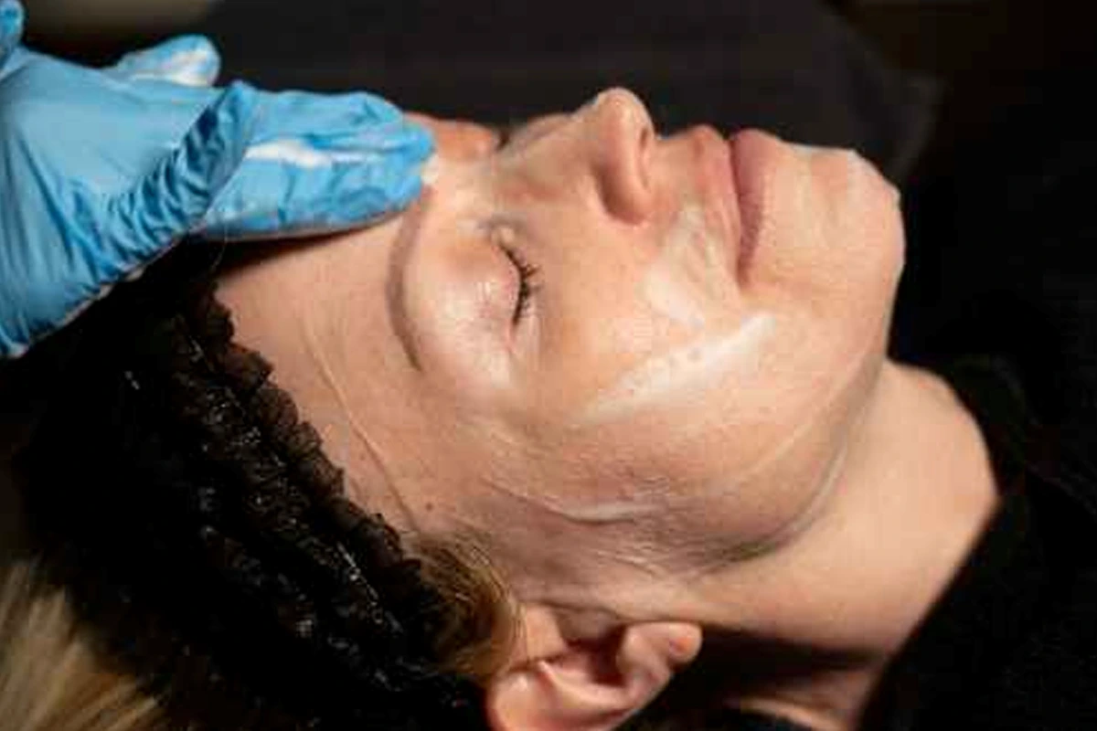 serum applied to soothe and hydrate skin after dermaplaning session at express med spa