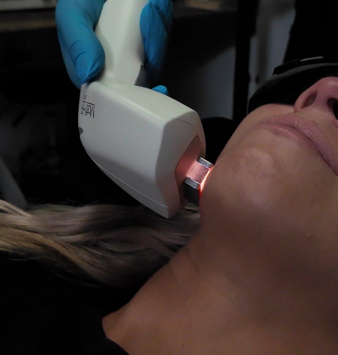 ideal candidate receiving professional laser hair removal at express medspa