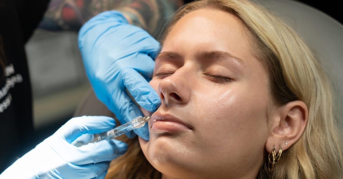 mini lip filler injection treatment natural lip enhancement express med spa