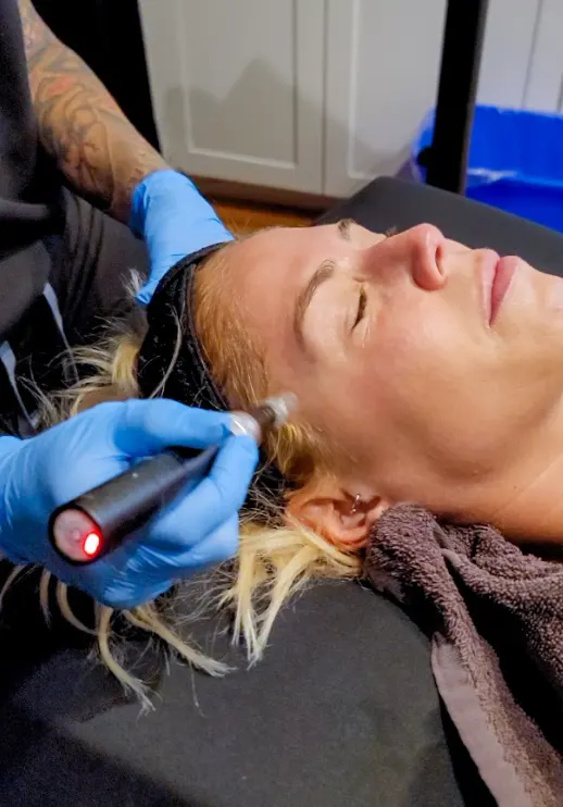 Microneedling session in progress at Express Med Spa in Frankfort IL
