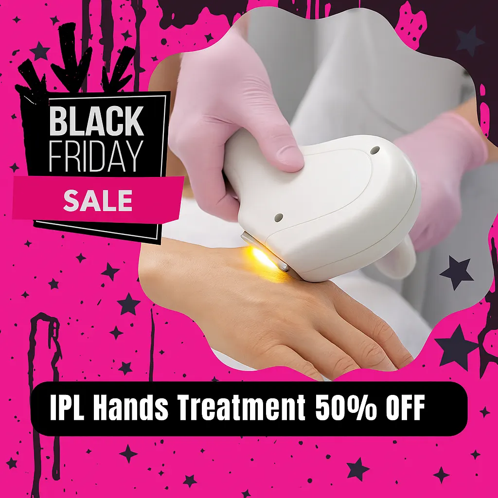 Black Friday 50% off IPL Hands Treatment targeting sun spots and discoloration at Express Med Spa