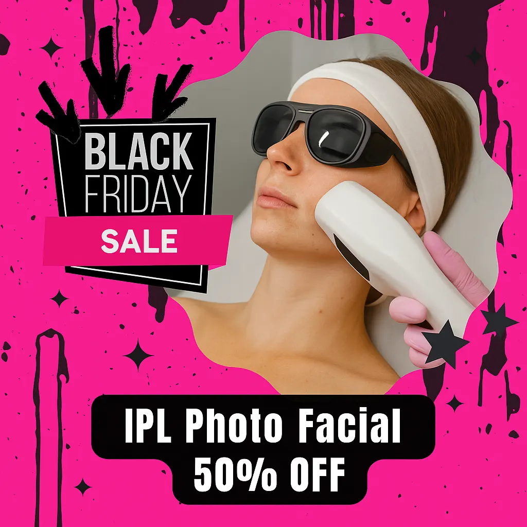 Black Friday 50% off IPL Photo Facial treatment promo with brightening and discoloration correction at Express Med Spa