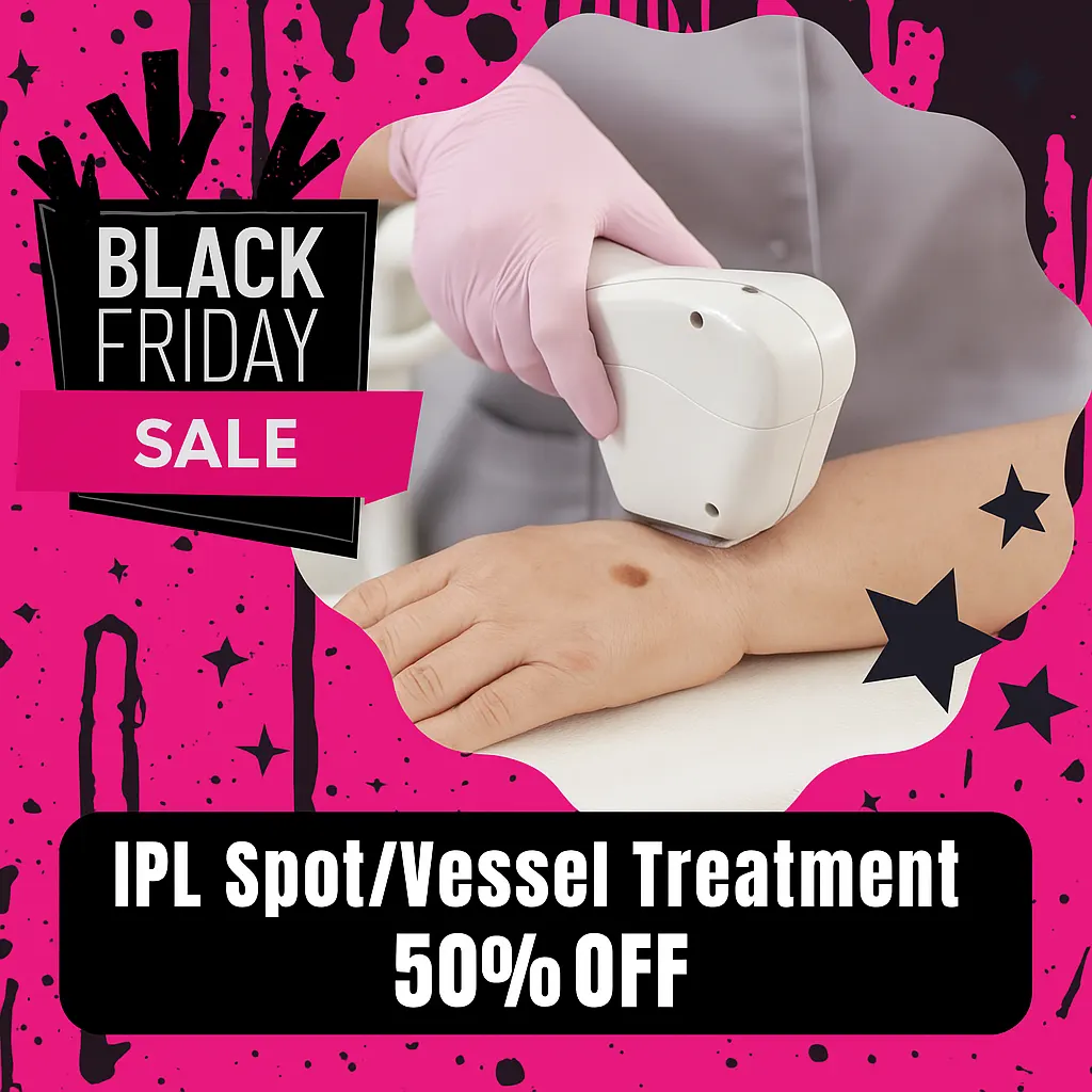Featured image for “IPL Spot Vessel Treatment December Sale 50% Off”
