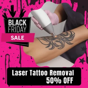 Black Friday 50% off medium area laser tattoo removal for dollar-bill-sized tattoos at Express Med Spa