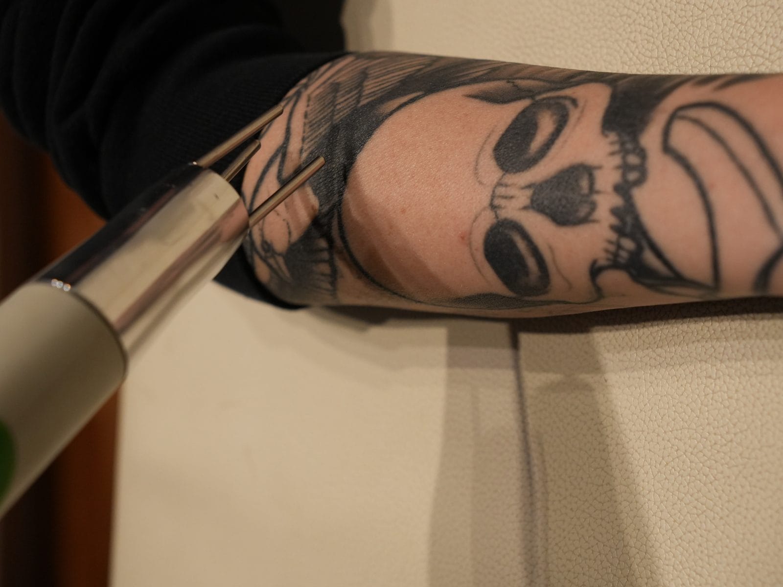 glutathione tattoo removal How Much Does Laser Cost? 2026 Guide under-1000 Size:7+1 Case Discount (1oz) title%% %%page%%