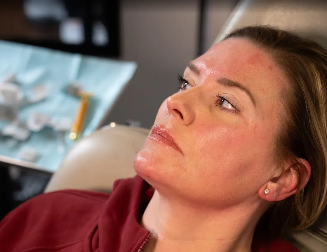 Patient after Letybo wrinkle injection session at Express Med Spa in Shorewood, IL showing refreshed appearance