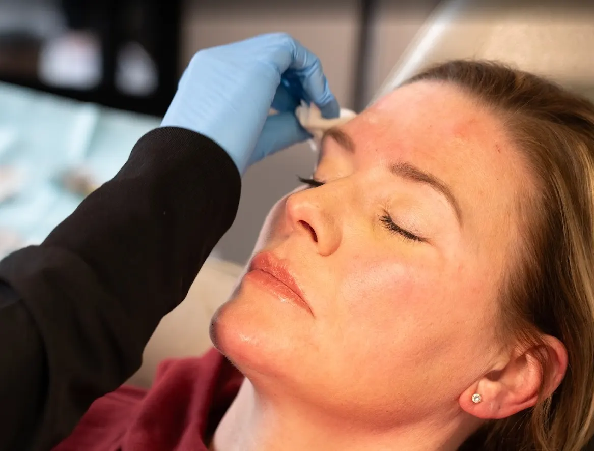 Injector preparing glabellar region for Letybo neurotoxin treatment at Express Med Spa in Frankfort, IL