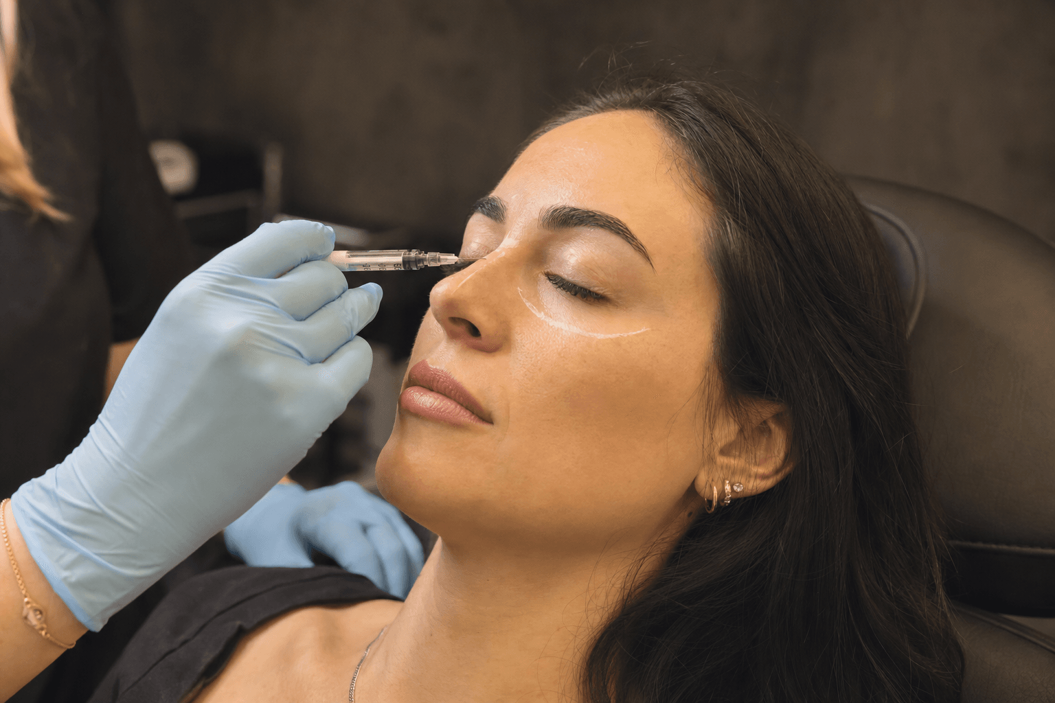 Nurse injector performing liquid rhinoplasty dermal filler injection on a patient's nasal bridge at Express Med Spa