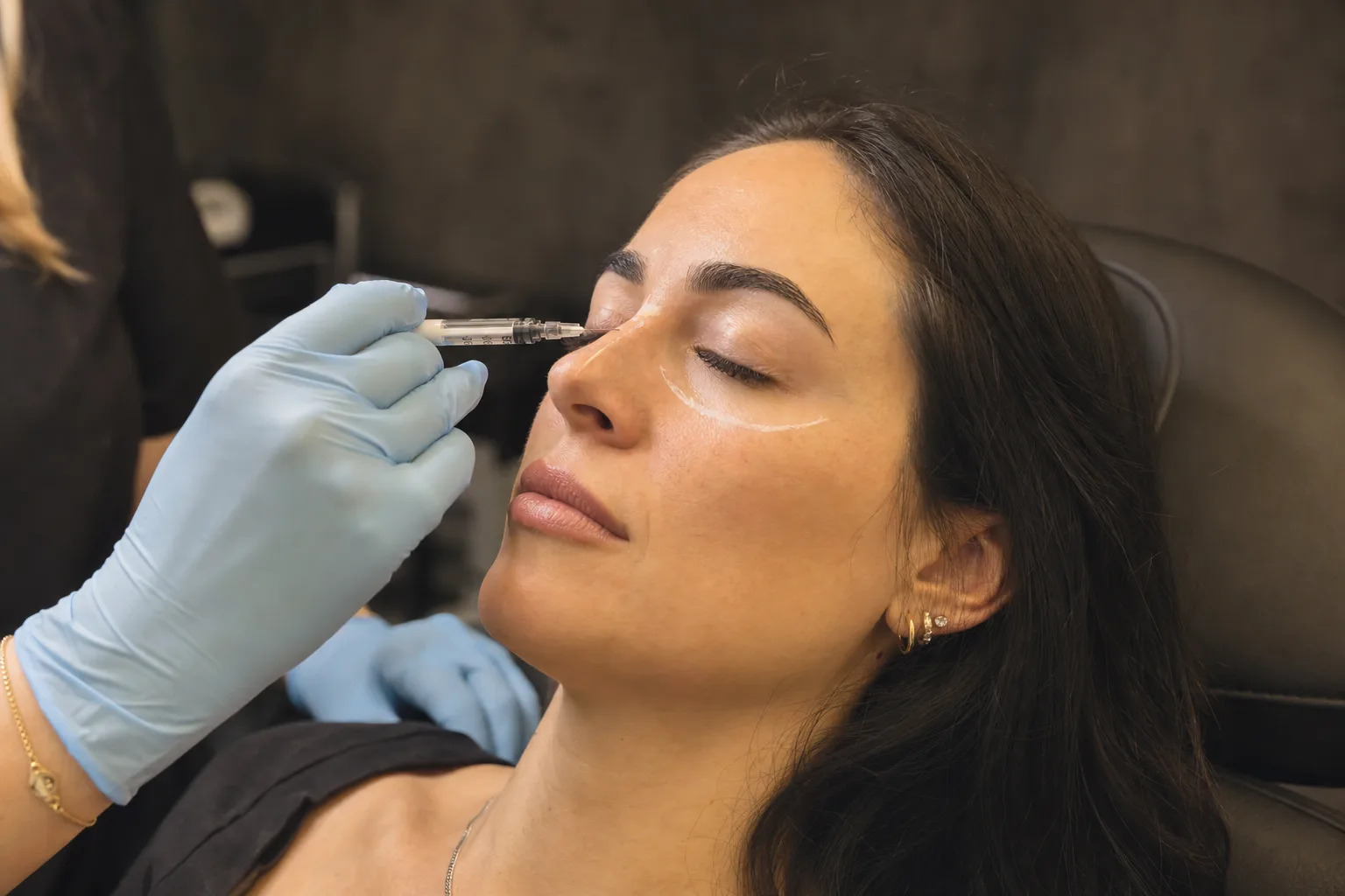 Dermal Fillers