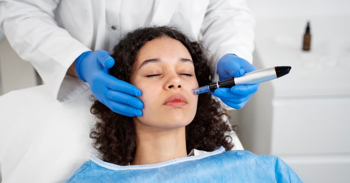 A client receives a professional microneedling procedure at Express Med Spa to boost collagen and rejuvenate skin.
