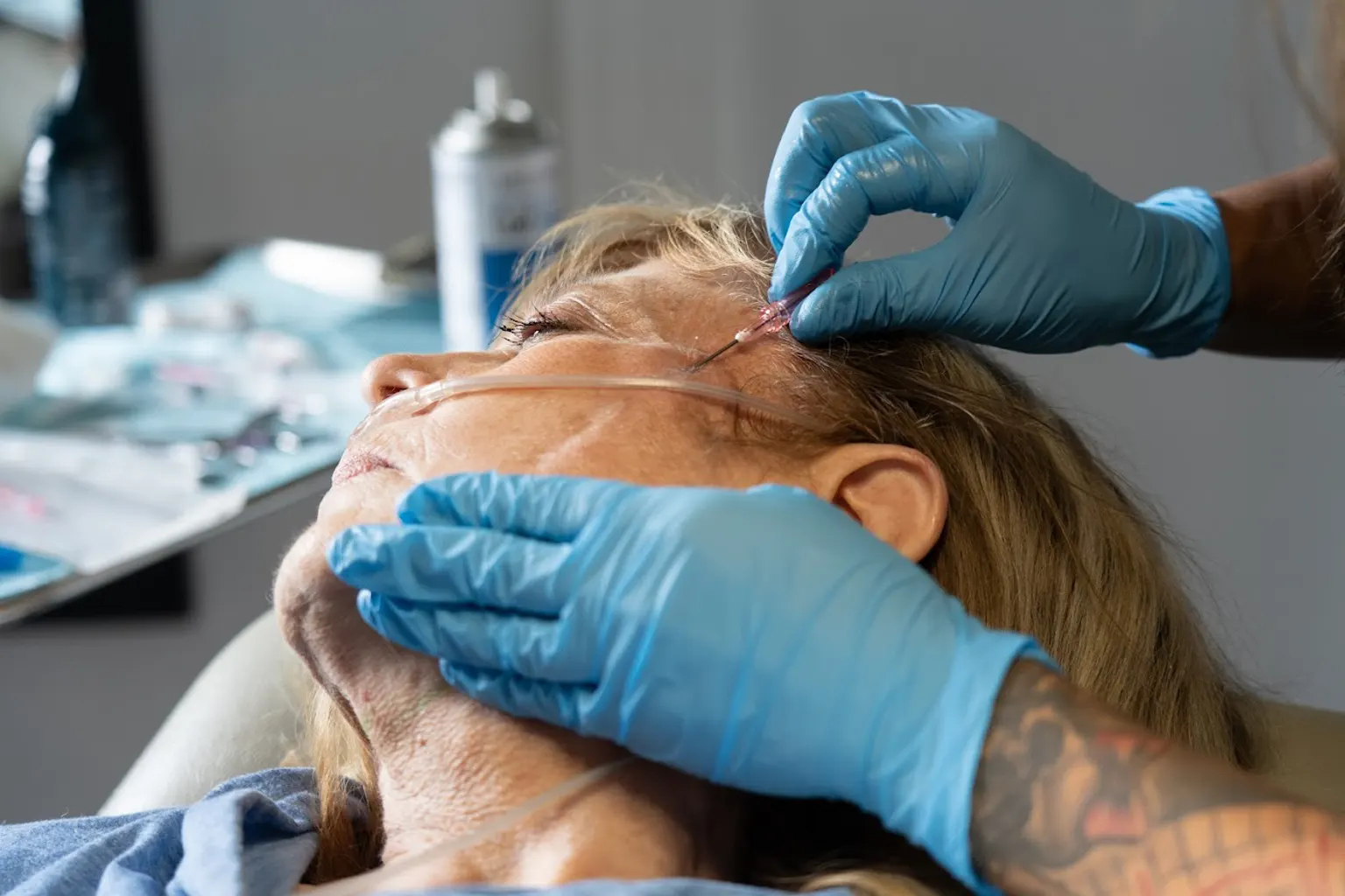 PDO thread lift brow lift Frankfort non-surgical eye lift with collagen threads.