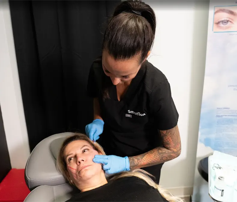 Provider performing PDO thread lift on midface region at Express Med Spa La Grange, IL, inserting threads to improve cheek support and lift sagging skin.