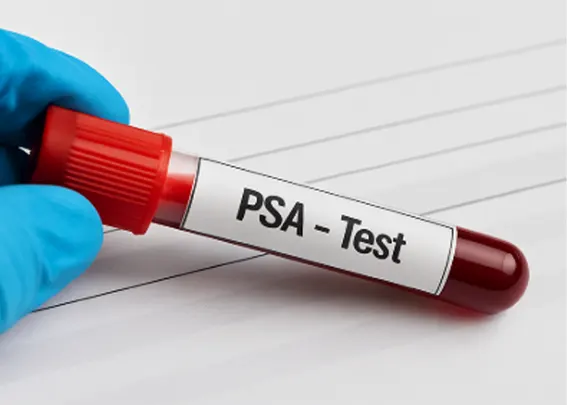 PSA test vial and promotional message for prostate cancer screening at Express Med Spa