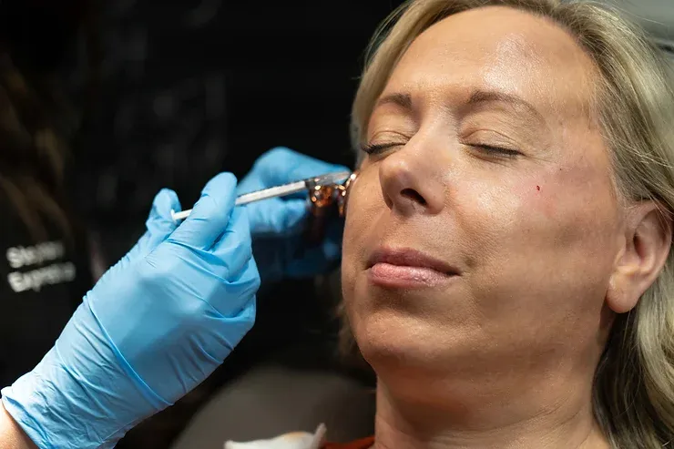 Radiesse filler for long-lasting facial volume and contour at Express Med Spa in Manteno, IL