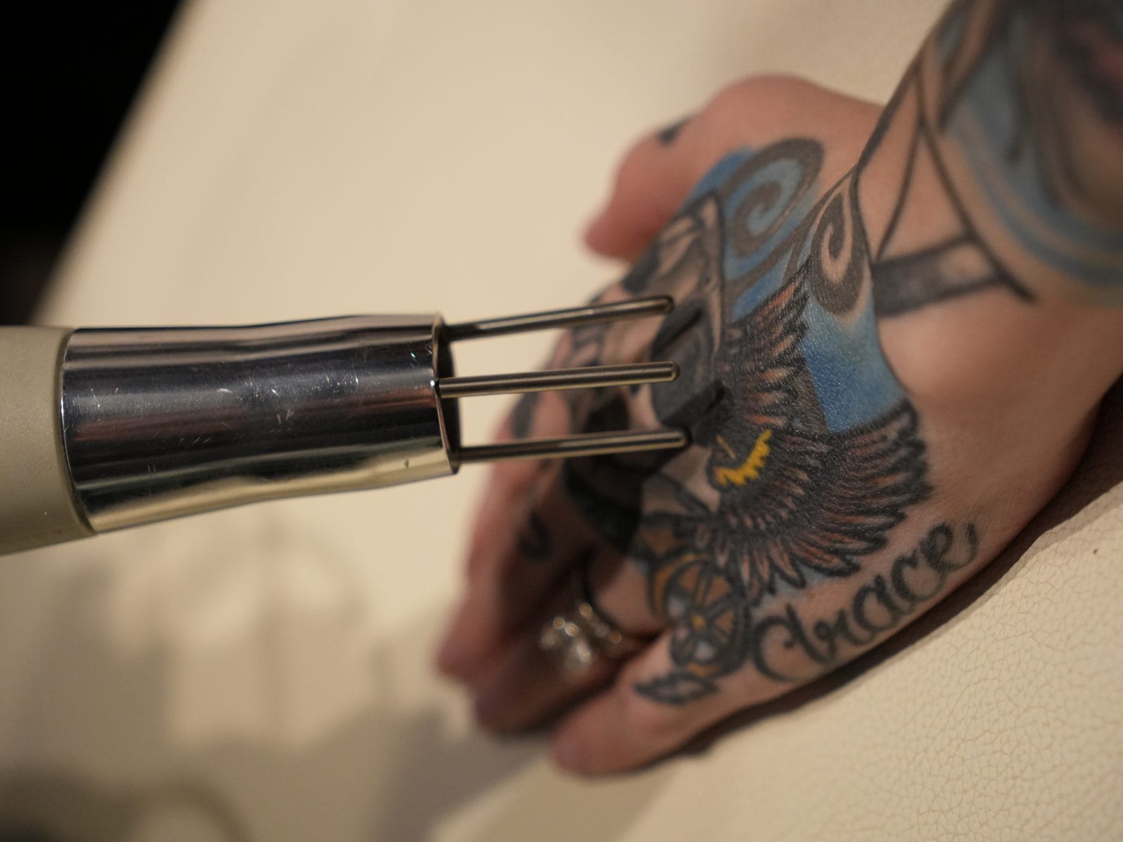 Laser applicator aimed at a small blue and grey owl hand tattoo lettered Grace at Express Med Spa in Frankfort, IL, the size of design priced in the small laser tattoo removal tier