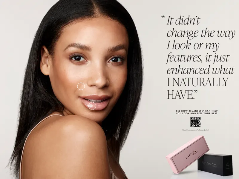 Smiling woman after Versa Lip Filler at Express Med Spa La Grange IL, showing natural, radiant beauty and confidence