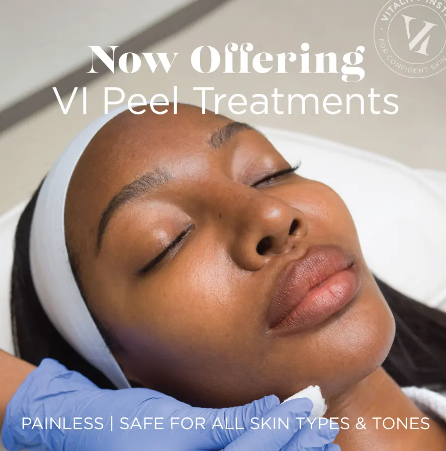 Woman with deep skin tone receiving gentle VI Peel post-treatment care at Express Med Spa