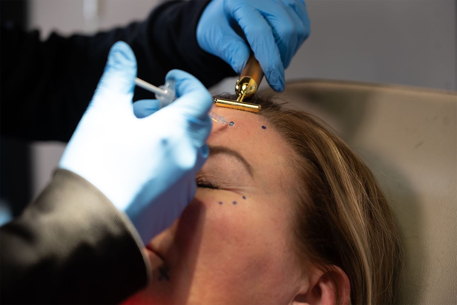 Nurse injector performing Xeomin treatment on forehead at Express Med Spa to reduce lines and relieve tension.