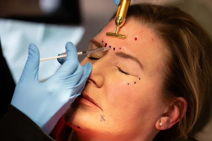 Xeomin for Crow’s Feet: How It Works + 8 Key Benefits for Smoother Eyes